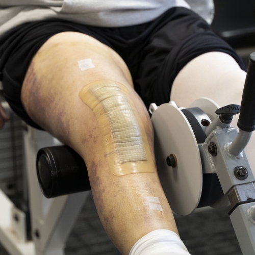 Clifton-Park-Physical-Therapy-Clifton-Park-NY-joint-replacement-059