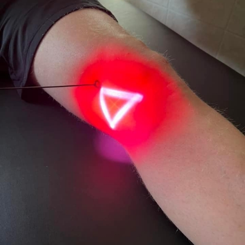 Clifton-Park-Physical-Therapy-Clifton-Park-NY-laser-therapy-2