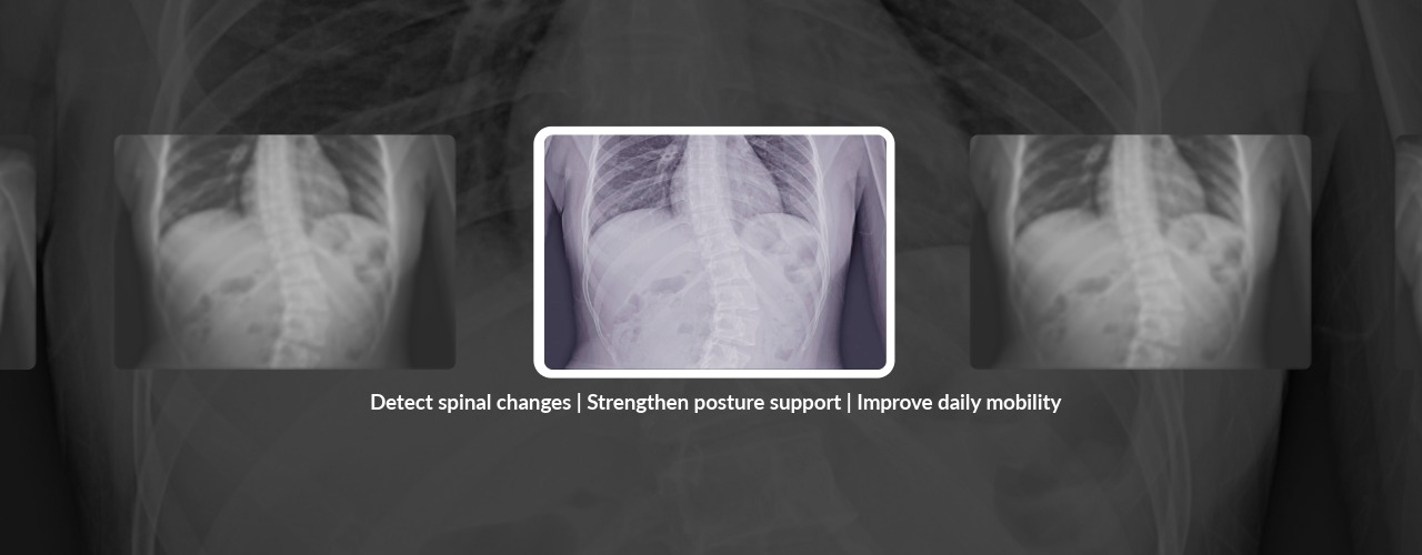 What Is Degenerative Scoliosis and Who Is at Risk?